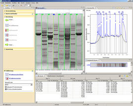 Biostep-ViewPix-Abb5