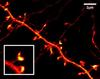 STED image of a nerve cell