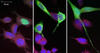 New Brain Protein