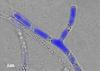 Contaminant transport in the fungal pipeline