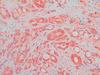 Tumorprotein gegen Tumorwachstum