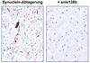 Forscher bremsen Parkinson bei Mäusen aus