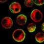 Cancerous B cells treated with rituximab