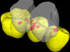 Material loss protects teeth against fatigue failure