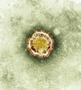 Tactics of new Middle East virus suggest treating by altering lung cells' response to infection