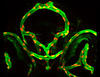 Blueprint for blood vessel fusion discovered