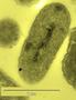 goldnanoparticle