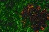 Neuartige optische Sonden für die Tumordiagnostik