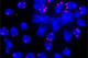 telomere